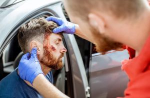 Navigating the Legal Process After a Car Accident Head Injury
